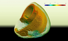 Cardioid image